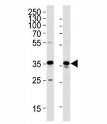Western blot analysis of lysate from HeLa, HUVEC cell line (left to right) using GAPDH antibody; Ab was diluted at 1:1000 for each lane.