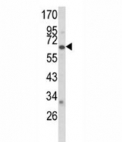 Western blot analysis of CYP2F1 antibody and A2058 lysate.
