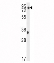 Western blot analysis of TBK1 antibody and K562 lysate. Predicted molecular weight: ~84 kDa.