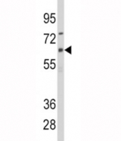 Western blot analysis of CYP1B1 antibody and CEM lysate