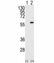Western blot analysis of STK4 / MST1 antibody and 293 cell lysate either nontransfected (Lane 1) or transiently transfected with the STK4 gene (2). Predicted molecular weight ~ 56 kDa.