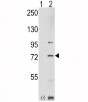 Western blot analysis of PAK1 antibody and 293 cell lysate either nontransfected (Lane 1) or transiently transfected with the PAK1 gene (2). Expected molecular weight 60~70kDa.