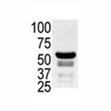Western blot testing of ovary lysate with PAK2 antibody.~