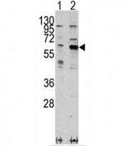 Western blot analysis of PAK3 antibody and 293 cell lysate either nontransfected (Lane 1) or transiently transfected with the PAK3 gene (2). Expected molecular weight ~62 kDa.