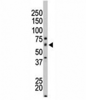 The PAK4 antibody used in western blot to detect PAK4 in mouse small intestine tissue lysate