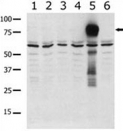 Western blot analysis of PAK5 antibody in lysate from transiently transfected COS7 cells. Lane 1: negative control, and transfected lysates 2: PAK1, 3: PAK2, 4: PAK4, 5: PAK5, and 6: PAK6-expressing cells.