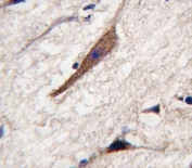 IHC analysis of FFPE human brain tissue stained with PAK5 antibody