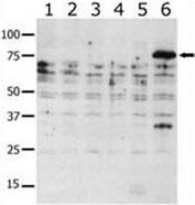 Western blot analysis of PAK6 antibody in lysate from transiently transfected COS7 cells. Lane 1: negative control, 2: PAK1, 3: PAK2, 4: PAK4, 5: PAK5, and 6: PAK6-expressing cells.