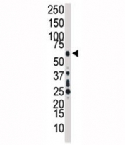 Western blot analysis of TAK1 antibody and HL-60 cell lysate. Predicted molecular weight: 64-69 kDa, routinely observed at 78-82 kDa.