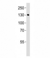 Western blot testing of mouse bladder tissue lysate using MLCK antibody at 1:1000. Predicted molecular weight: isoforms from 197-211 kDa and ~110 kDa.