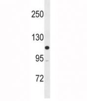 Western blot testing of human SK-BR-3 lysate with MLCK antibody. Predicted molecular weight: isoforms from 197-211 kDa and ~110 kDa.