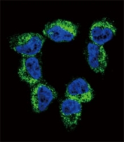 Confocal immunofluorescent analysis of BDNF antibody with NCI-H460 cells followed by Alexa Fluor 488-conjugated goat anti-rabbit lgG (green). DAPI was used as a nuclear counterstain (blue).