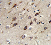 IHC analysis of FFPE human brain stained with BDNF antibody