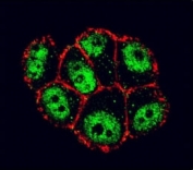 Confocal immunofluorescent analysis of IkB alpha antibody with ZR-75-1 cells followed by Alexa Fluor 488-conjugated goat anti-rabbit lgG (green). Actin filaments have been labeled with Alexa Fluor 555 Phalloidin (red).