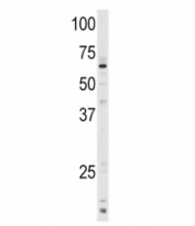 Western blot analysis of CYP1A1 antibody and mouse lung tissue lysate