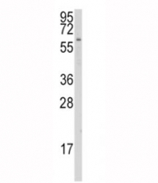 Western blot analysis of CYP1A1 antibody and K562 lysate. Predicted molecular weight ~58 kDa.