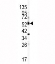 Western blot analysis of CYP1A1 antibody and mouse lung tissue lysate. Predicted molecular weight ~58kDa.