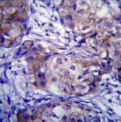 CYP1A1 antibody immunohistochemistry analysis in formalin fixed and paraffin embedded human breast carcinoma.