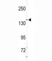 Western blot analysis of NIK antibody and Jurkat lysate. Predicted molecular weight ~140 kDa.