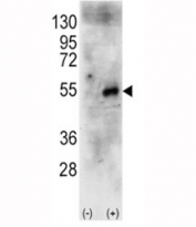 Western blot analysis of p70S6Kb antibody and 293 cell lysate (2 ug/lane) either nontransfected (Lane 1) or transiently transfected with the human RPS6KB2 gene (2). Predicted molecular weight: 60-70 kDa