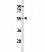 Western blot analysis of S6K2 antibody and human K562 lysate. Predicted molecular weight: 60-70 kDa.