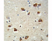IHC analysis of FFPE mouse brain tissue stained with RPS6KB2 antibody.