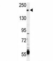 TRPM6 antibody western blot analysis in CEM lysate