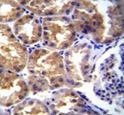 TRPM6 antibody immunohistochemistry analysis in formalin fixed and paraffin embedded human kidney tissue.