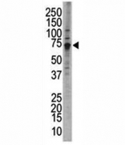 Western blot analysis of Wee1 antibody and HL-60 cell lysate; Predicted molecular weight ~72 kDa.