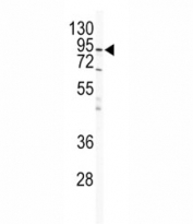 Western blot analysis of IKK beta antibody and HeLa lysate. Predicted molecular weight ~87 kDa.