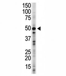 GSK3B antibody used in western blot to detect GSK3B in 293 cell lysate. Predicted molecular weight ~50 kDa.~