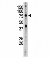 IKKE antibody used in western blot to detect IKKE in 293 cell lysate