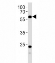 Western blot analysis of lysate from human kidney tissue using PFKFB3 antibody at 1:1000.