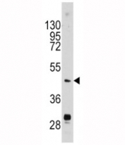 Western blot analysis of Urokinase antibody and mouse brain tissue lysate