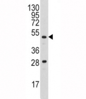 Western blot analysis of Urokinase antibody and A2058 lysate