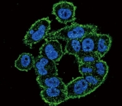 Confocal immunofluorescent analysis of UPA antibody with A2058 cells followed by Alexa Fluor 488-conjugated goat anti-rabbit lgG (green). DAPI was used as a nuclear counterstain (blue).