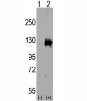 Western blot analysis of TRPM8 antibody and 293 cell lysate either nontransfected (Lane 1) or transiently transfected with the TRPM8 gene (2). Predicted molecular weight ~128 kDa.