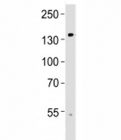Western blot analysis of lysate from human brain tissue using TRPM8 antibody at 1:1000. Predicted molecular weight ~128 kDa.