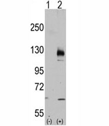 Western blot analysis of TRPM8 antibody and 293 cell lysate either nontransfected (Lane 1) or transiently transfected with the TRPM8 gene (2). Predicted molecular weight ~128 kDa.~