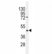 PTEN antibody western blot analysis in HL-60 lysate