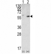 Western blot analysis of PTEN antibody and 293 cell lysate (2 ug/lane) either nontransfected (Lane 1) or transiently transfected with the PTEN gene (2).