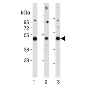 Western blot testing of 1) human HepG2, 2) human brain and 3) rat brain with DUSP6 antibody. Predicted molecular weight 42/26 kDa (isoform 1/2).
