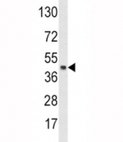 Western blot analysis of SKP2 antibody and HeLa lysate. Predicted molecular weight ~48 kDa