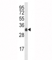 Western blot analysis of MyD88 antibody and HepG2 lysate. Predicted molecular weight: 33 kDa