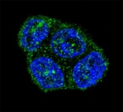 Confocal immunofluorescent analysis of Fas antibody with T47D cells followed by Alexa Fluor 488-conjugated goat anti-rabbit lgG (green). DAPI was used as a nuclear counterstain (blue).