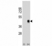 Western blot analysis of Fas antibody and 293 cell lysate (2 ug/lane) either nontransfected (Lane 1) or transiently transfected (2) with the human gene. Predicted molecular weight: ~38 kDa (unmodified), 40-55 kDa (glycosylated).