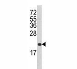 Western blot analysis of FAS antibody and T47D lysate. Soluble form ~26 kDa, membrane form ~40 kDa