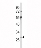 Western blot analysis of IL-1B antibody and NCI-H460 lysate. Predicted molecular weight: 31 kDa (precursor) and 17 kDa (mature).