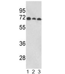 Western blot analysis of ABI1 antibody and human 1) MCF-7, 2) CEM, and 3) Jurkat lysate. Predicted molecular weight ~55 kDa.