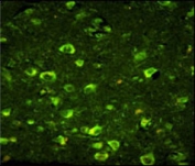 Immunofluorescence analysis of ABI1 antibody with paraffin-embedded human brain tissue. Primary antibody was followed by FITC-conjugated goat anti-rabbit lgG (green).